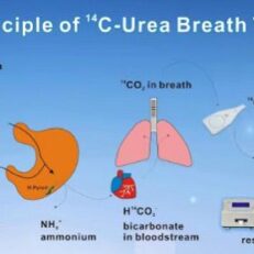 C14 Urea Breath Test