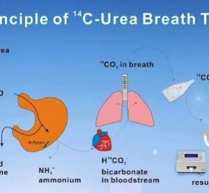 C14 Urea Breath Test
