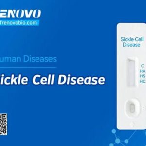 Sickle cell disease test